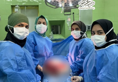 خارج کردن توده تخمدانی ۶/۵ کیلوگرمی از بدن بانوی کاشانی