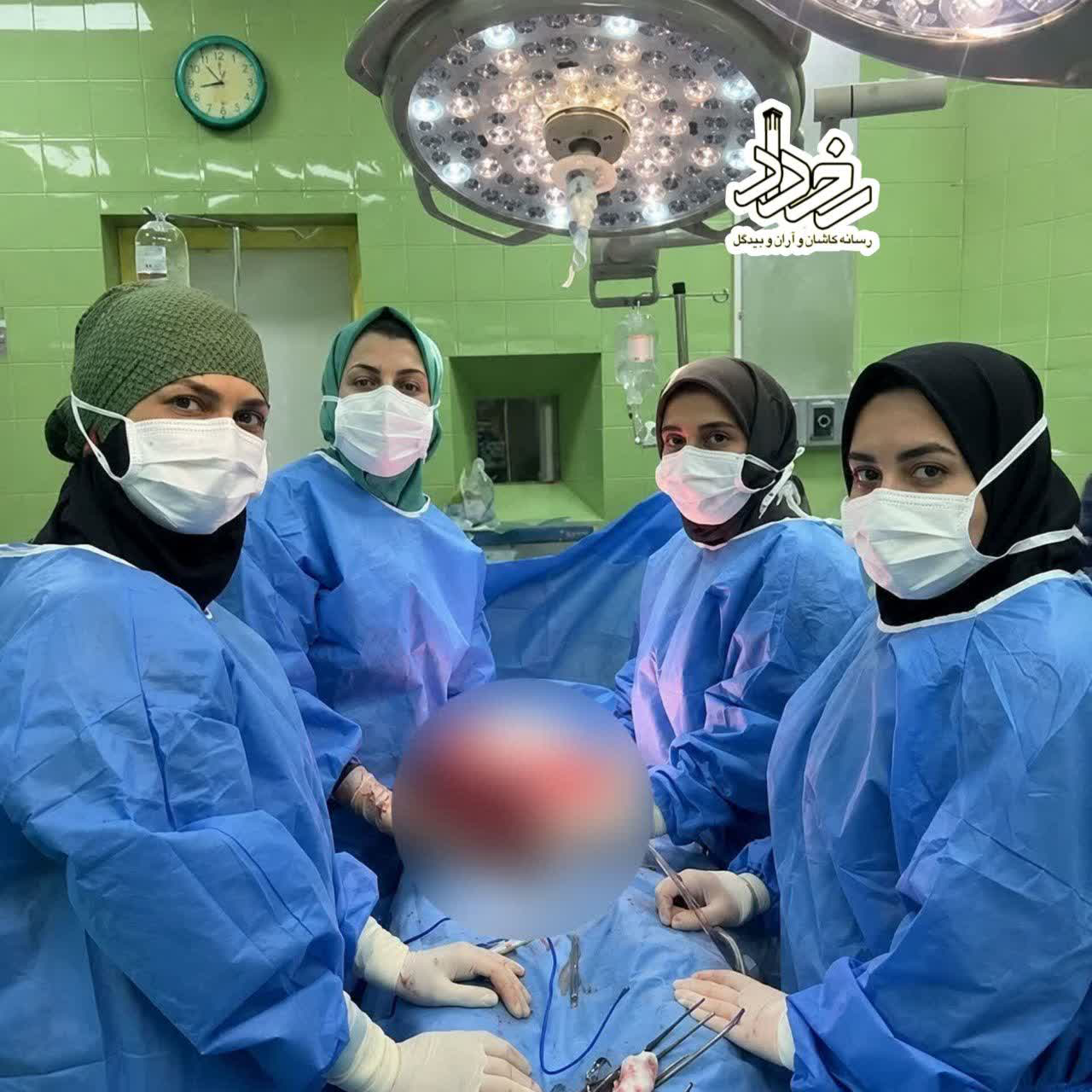 خارج کردن توده تخمدانی ۶/۵ کیلوگرمی از بدن بانوی کاشانی خارج کردن توده تخمدانی ۶/۵ کیلوگرمی از بدن بانوی کاشانی